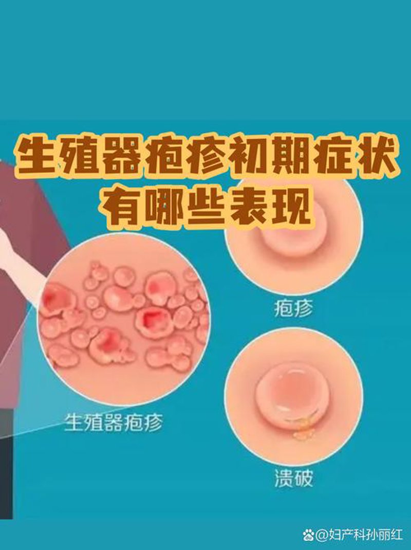 许昌生殖感染